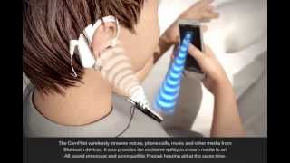 Bimodal one ear hearing aid other ear implant”AB & Phonak Partners for Better Hearing [English Subtitles]”