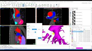Tutorial: Automatic Heart Segmentation Using CT Heart Tool