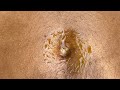 Navel Care Exploring The Benefits Of Belly Button Massage