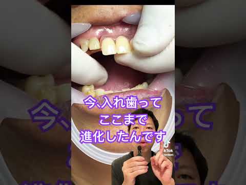 デンタルリウム sp.化石
