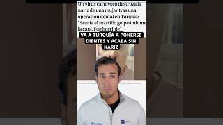 Le DESTROZÓ la NARIZ un tratamiento dental en Turquía 😱 | ¿Virus carnívoro?