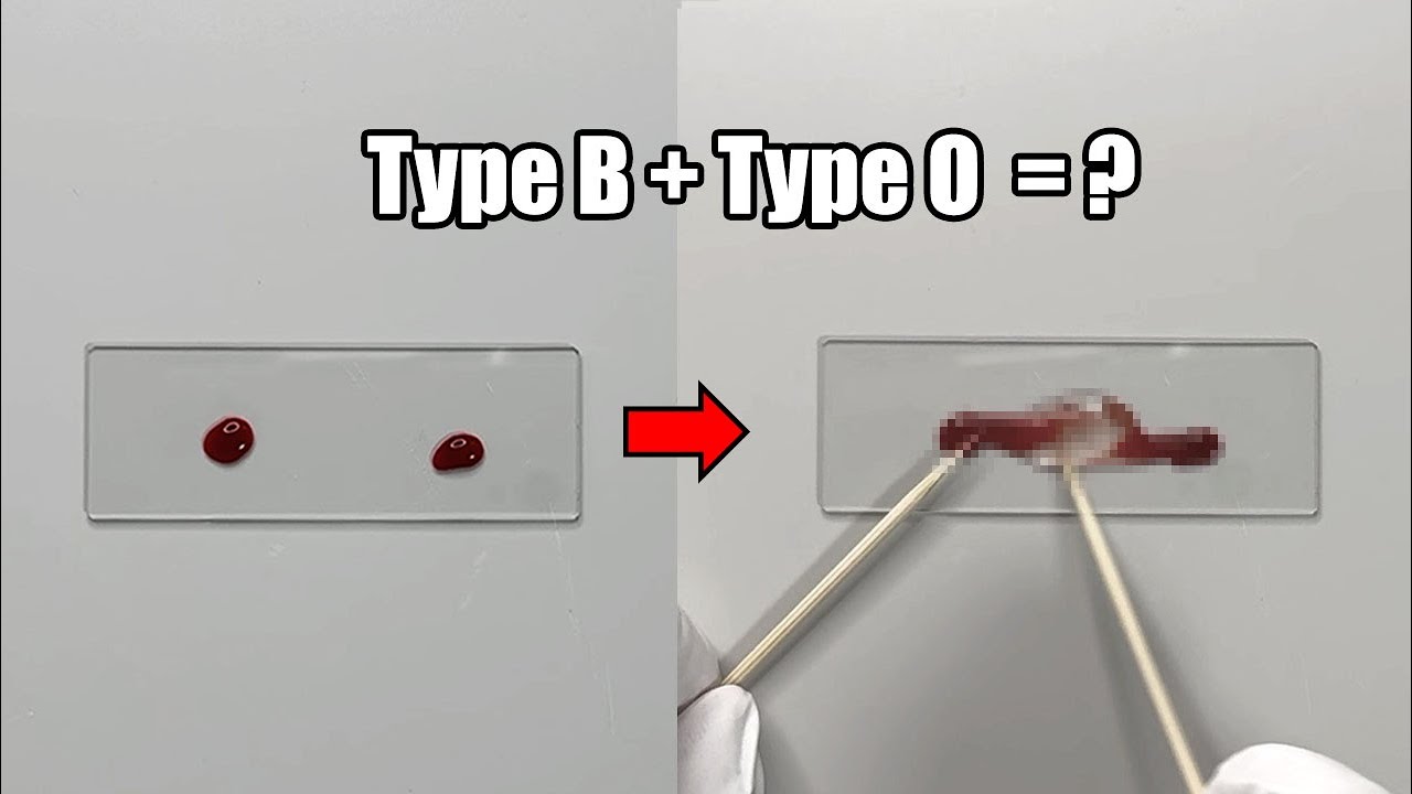 What Happens When Two Different Blood Types are Mixed Together?