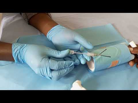 Insertion of implants (Jadelle/Levoplant)