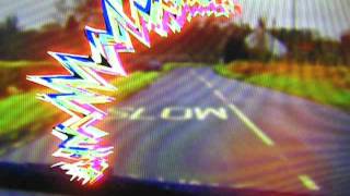 Visual Migraine Animation