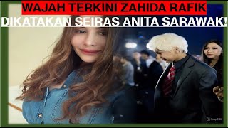 Download lagu HAMPIR TAK DIKENALI‼️Tiada Lagi Wajah Cantik Zahida Rafik Yang Kini Dikatakan Seiras Anita Sarawak‼️ mp3