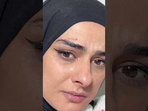 Ya gözüme gelseydi  😭😭 sonra çok üzüldü şila masum masum bakıyor