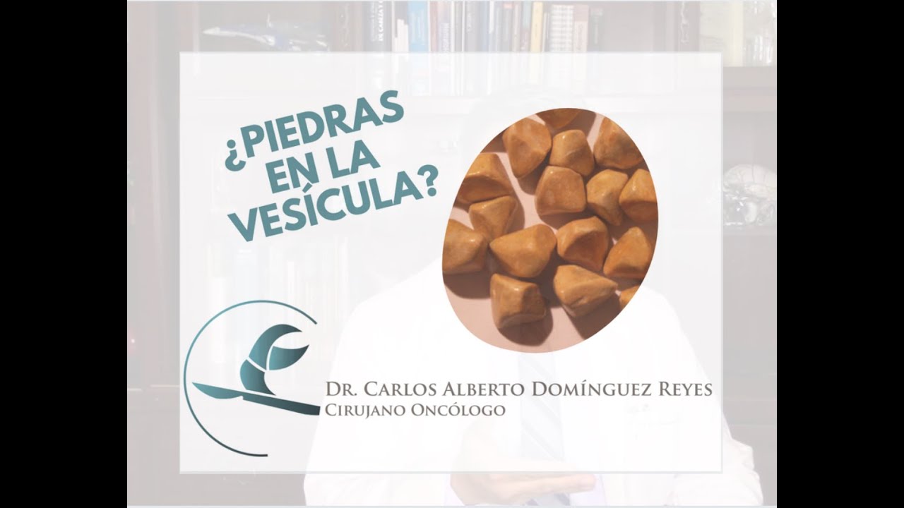 Carlos Alberto Domínguez Reyes-5