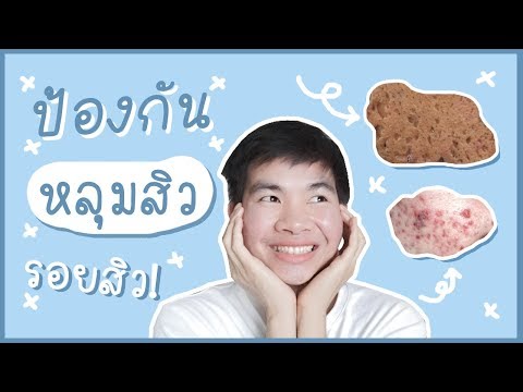 กลากวิธีการรักษาวิธีการของผู้คน ปัสสาวะช่วยป้องกันโรคสะเก็ดเงิน