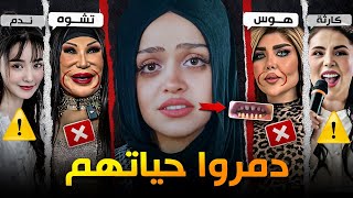 أخطر عمليات تجميل دمّرت وجوه المشاهير #5