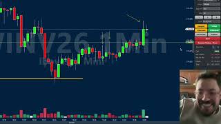 Suriel Ports ainda faz day trade? A resposta