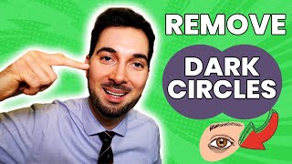 How To Remove Dark Circles Under Eyes Home Remedy and Treatment