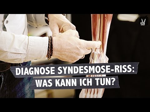 Syndesmosis tear – every footballer’s nightmare!
