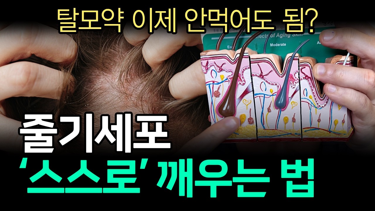 요즘 핫한 줄기세포 탈모치료, 90%는 '이 지방'이 결정합니다 (줄기세포 치료의 핵심)