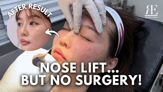 I Tried the HIKO Nose Filler at Renovo | Instant Nose Lift Without Surgery