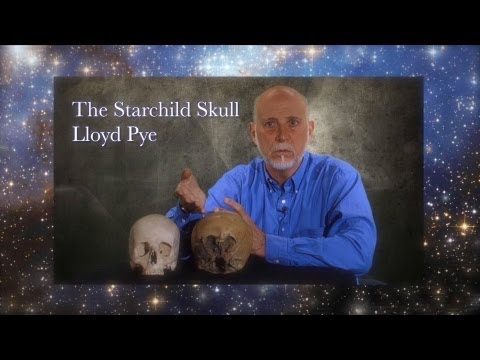 Starchild Skull DNA is Alien - Lloyd Pye