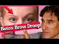 Can You Fix Droopy Eyebrow From Botox