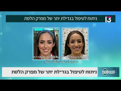 ניתוח לטיפול בגדילת יתר של מפרק הלסת