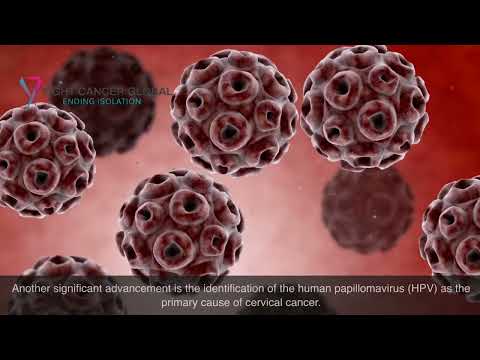 Targeted therapy session for advanced cervical cancer