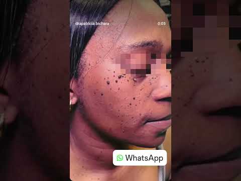 Patrícia Bichara De Carvalho Moreira-23