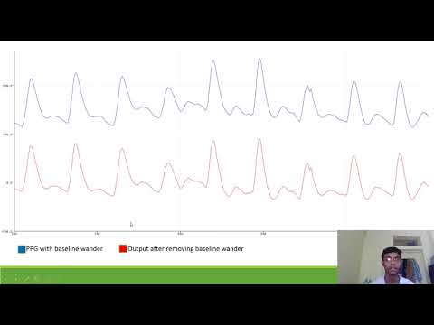 17EC01035 | LAB 6 | filter design using pole-zero placement method