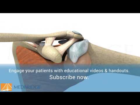 Shoulder Impingement Video - Patient Education | MedBridge