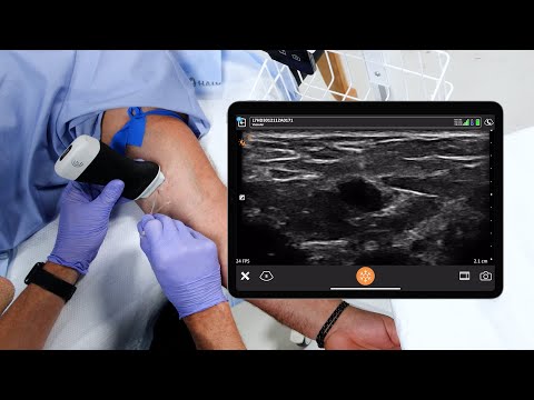 Peripheral Venous Catheter Placement