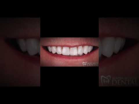 Are you ready for a change