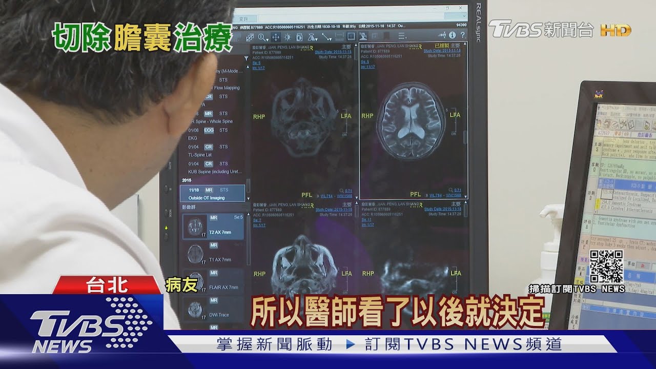 腹部這「器官」痛起來!須進行切除 醫師:正常飲食!