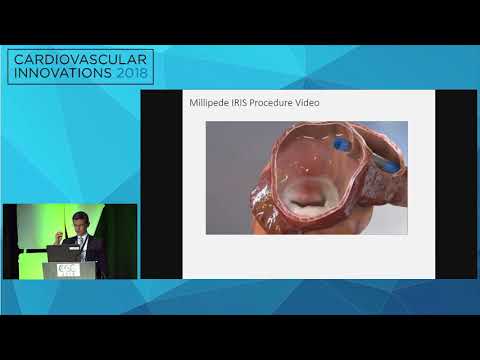 CVI2018 Session: The Top 5 latest innovations in transcatheter MV therapy - Jason Rogers, MD