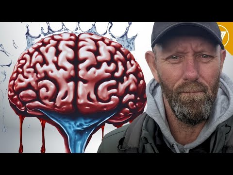 Alcoholic Wet Brain: Odds for Drinkers? Pay Attention If You Drink Alcohol!