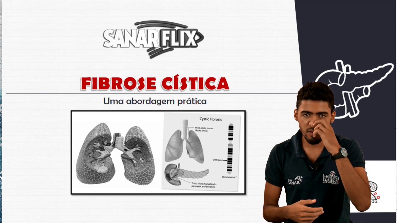 Fibrose Cística - Módulo de Pneumologia - Aula SanarFlix