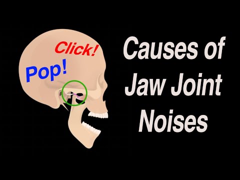 Causes of Jaw Joint Noises: Snap, Crackle, and Pop!