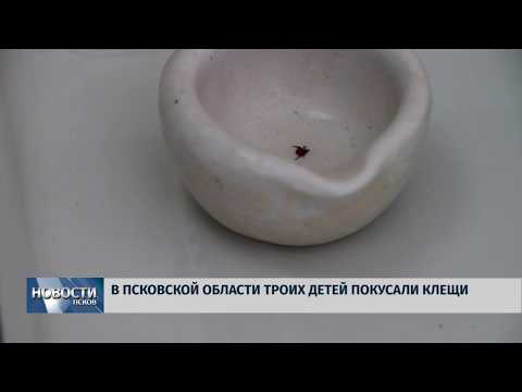 03.04.2019 / В Псковской области троих детей покусали клещи