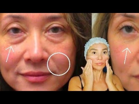 Every Morning De-Puffing Lymphatic-Drainage massage