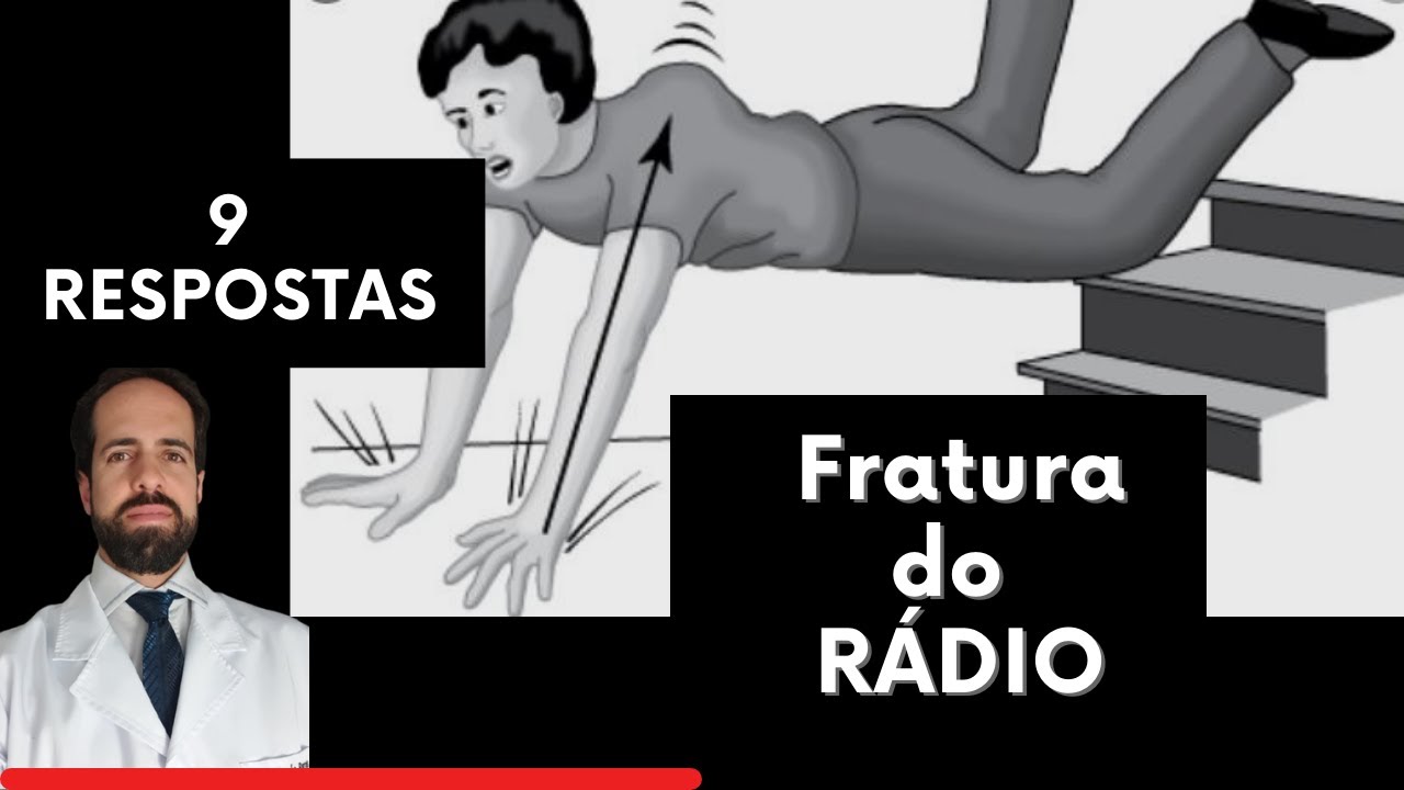 Rádio distal - 9 Respostas sobre o Tratamento Conservador