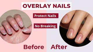 Overlay Nails - What are they & Benefits