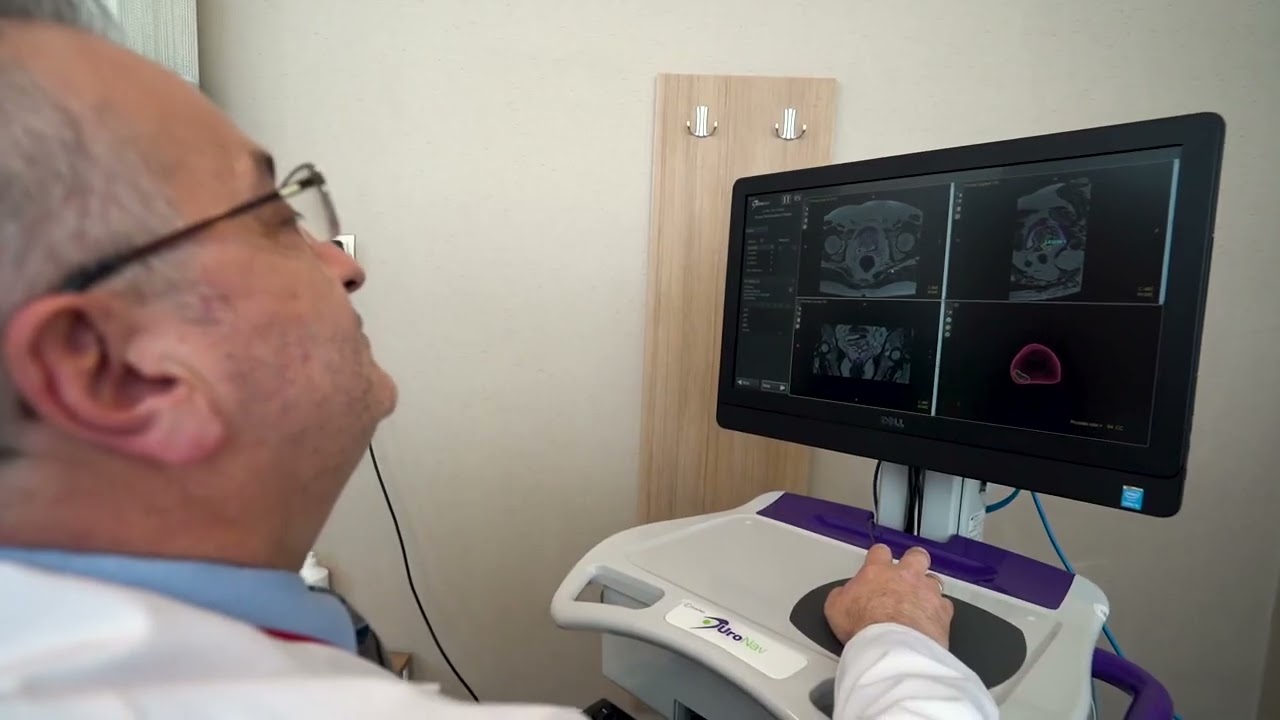 Prostat füzyon biyopsi nedir    Prof  Dr  Ali Fuat Atmaca Üroloji Uz