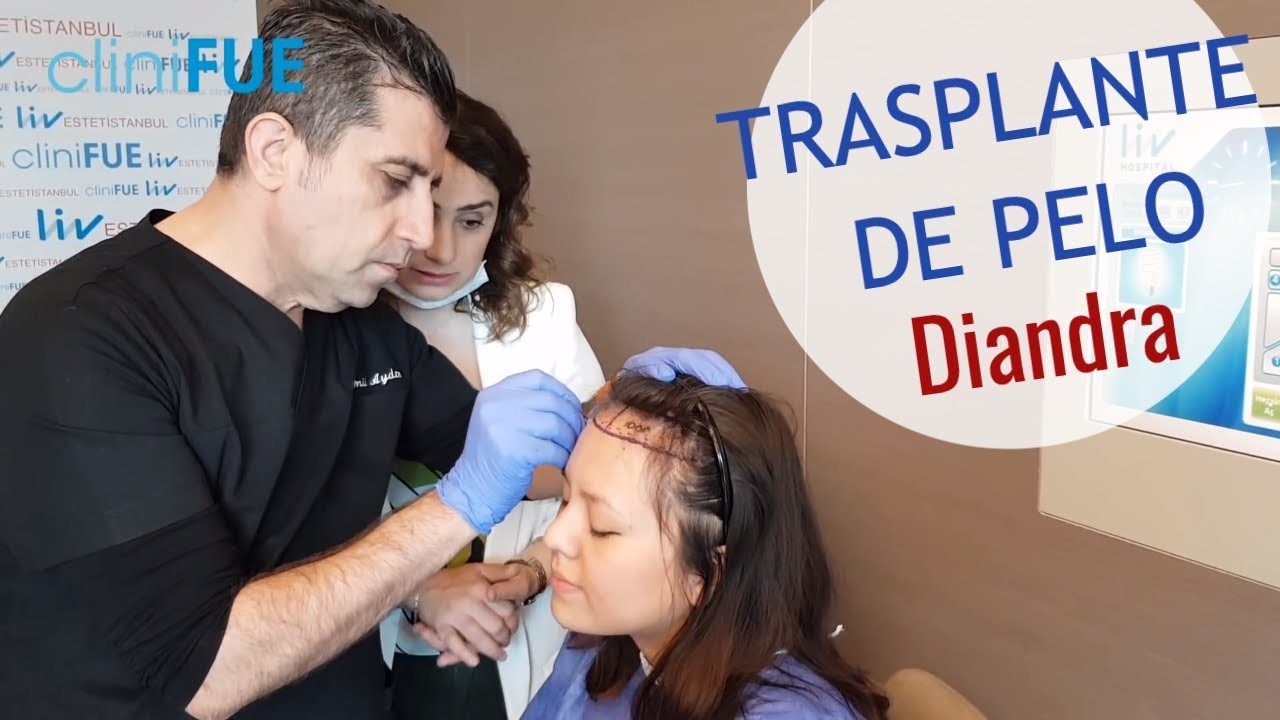 La decisión de Diandra sobre su TRASPLANTE DE PELO - Episodio 1
