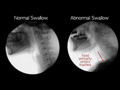 Amateur Swallowing