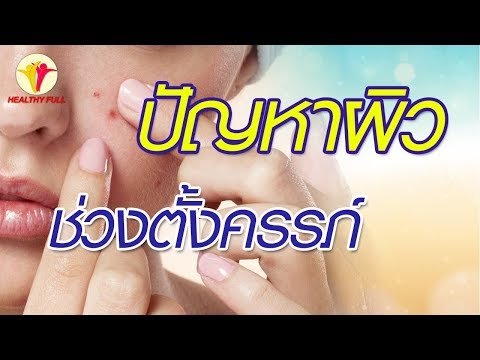ไดอาน่าขยาย 35 เต้านม ซิลิโคนชุดชั้นในหน้าอกใหญ่