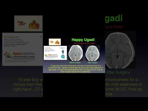 Road Accident Recovery Story 