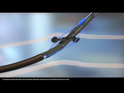 U.S. Perclose ProStyle Knot Animation