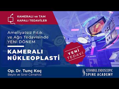 Yeni Kameralı Nükleoplasti Tedavisi