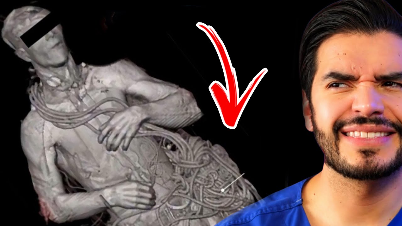⚠️Los MISTERIOS MÉDICOS en RAYOS X más RAROS | Doctor Vic