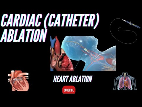 What is pacemaker how to work and Working Principle Advantage and Disadvantage