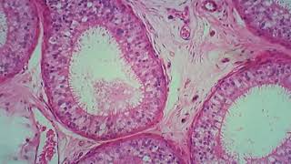 Histologia do Epidídimo