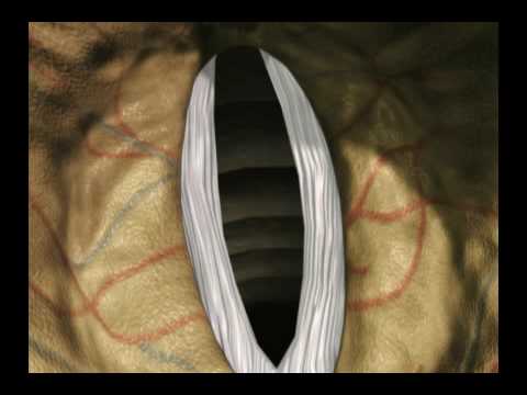 Vocal cords Animation