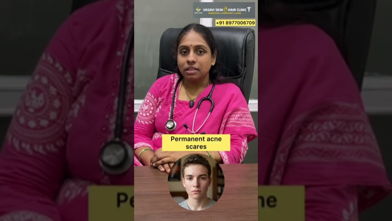 Are you a Teenager suffering with Acne. For personalized guidance visit Vasavi Skin and Hair Clinic