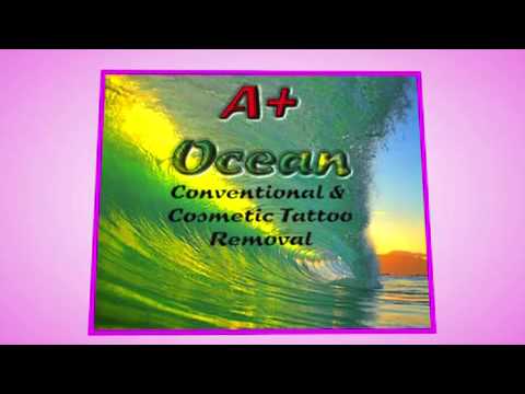 Cosmetic and Traditional Tattoo Removal Perth - Dynamic Skin