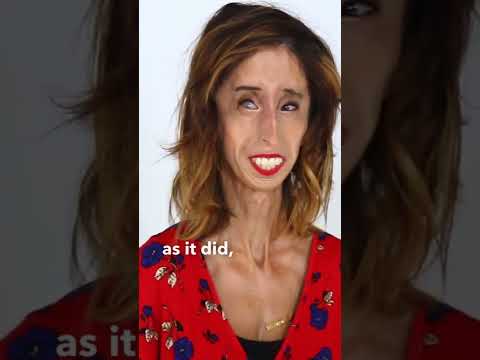 What Makes “The Ugliest Woman in the World” Beautiful: Redefining Beauty Standards